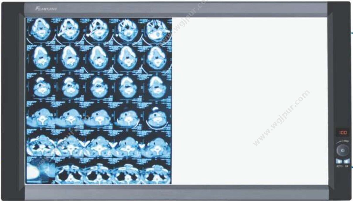 兆丰光电 MPLENT X射线胶片观片灯 ZG-1B 观片灯