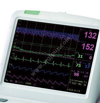 奥生 SZOSEN 母亲胎儿监护仪 X9 母胎监护仪