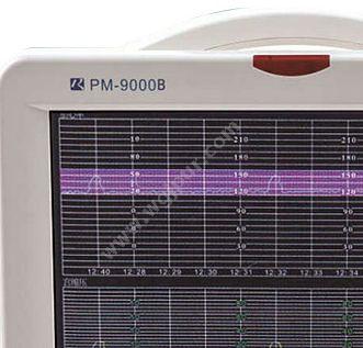 瑞博 胎儿多参数监护仪 PM-9000B 母胎监护仪