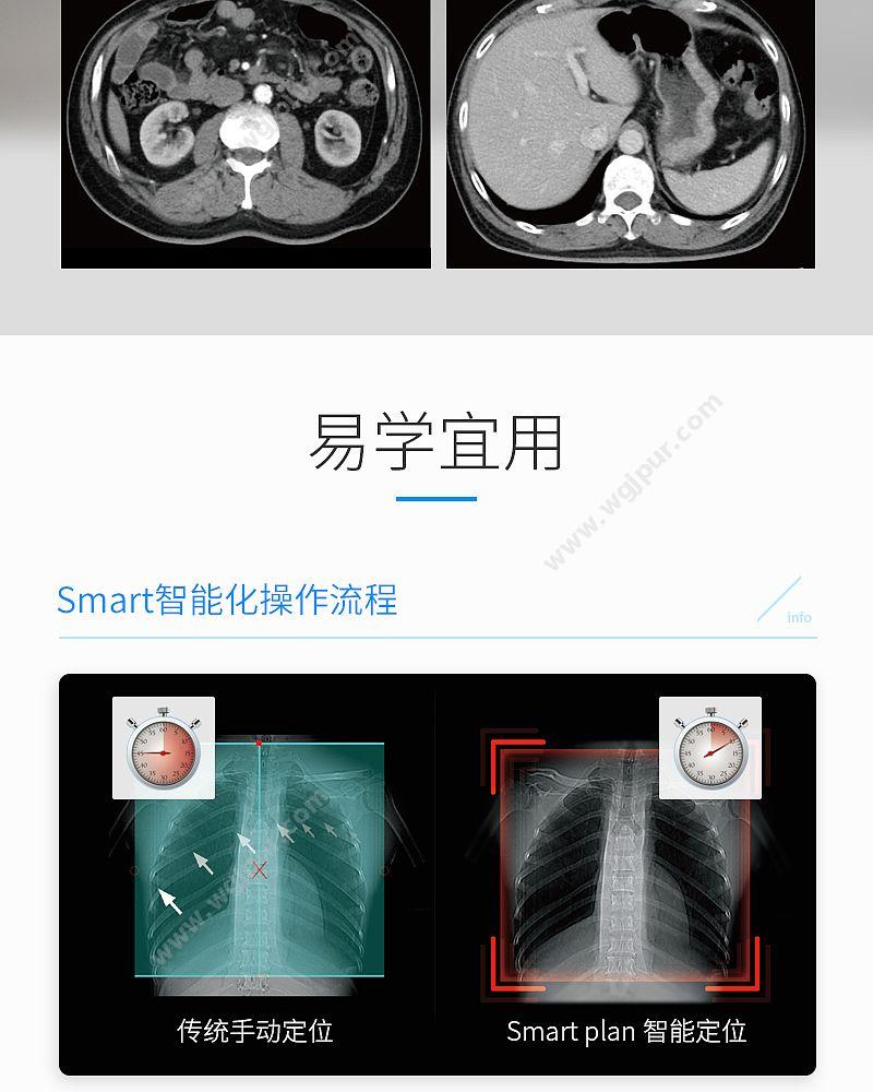 GE医疗 16排CT X射线计算机体层摄影设备 Revolution ACTs钻石版32层 CT