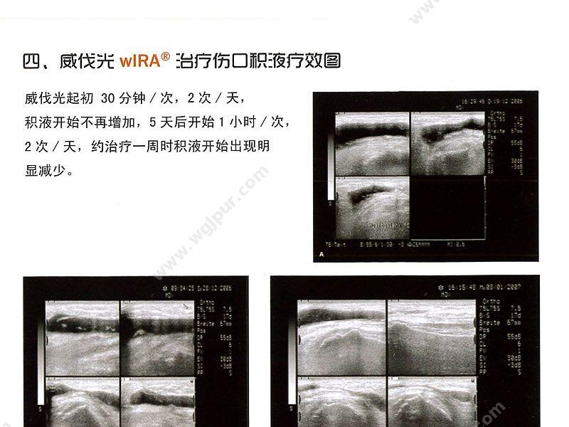 海特科技 Hydrosun 红外辐照治疗装置 500型 红外线治疗仪