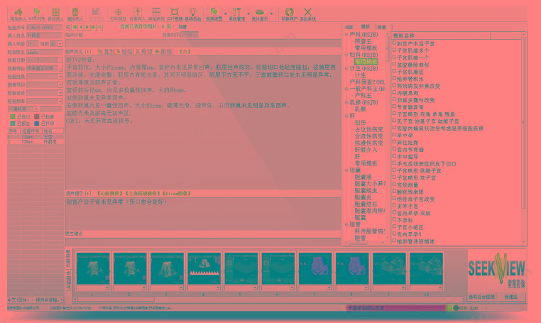 索图 医学影像工作站系统软件 SEEKER-200（带电脑打印机标清版） 电池/台车/背包